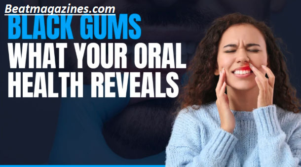 Why Are My Gums Black? 7 Surprising Causes You Shouldn’t Ignore