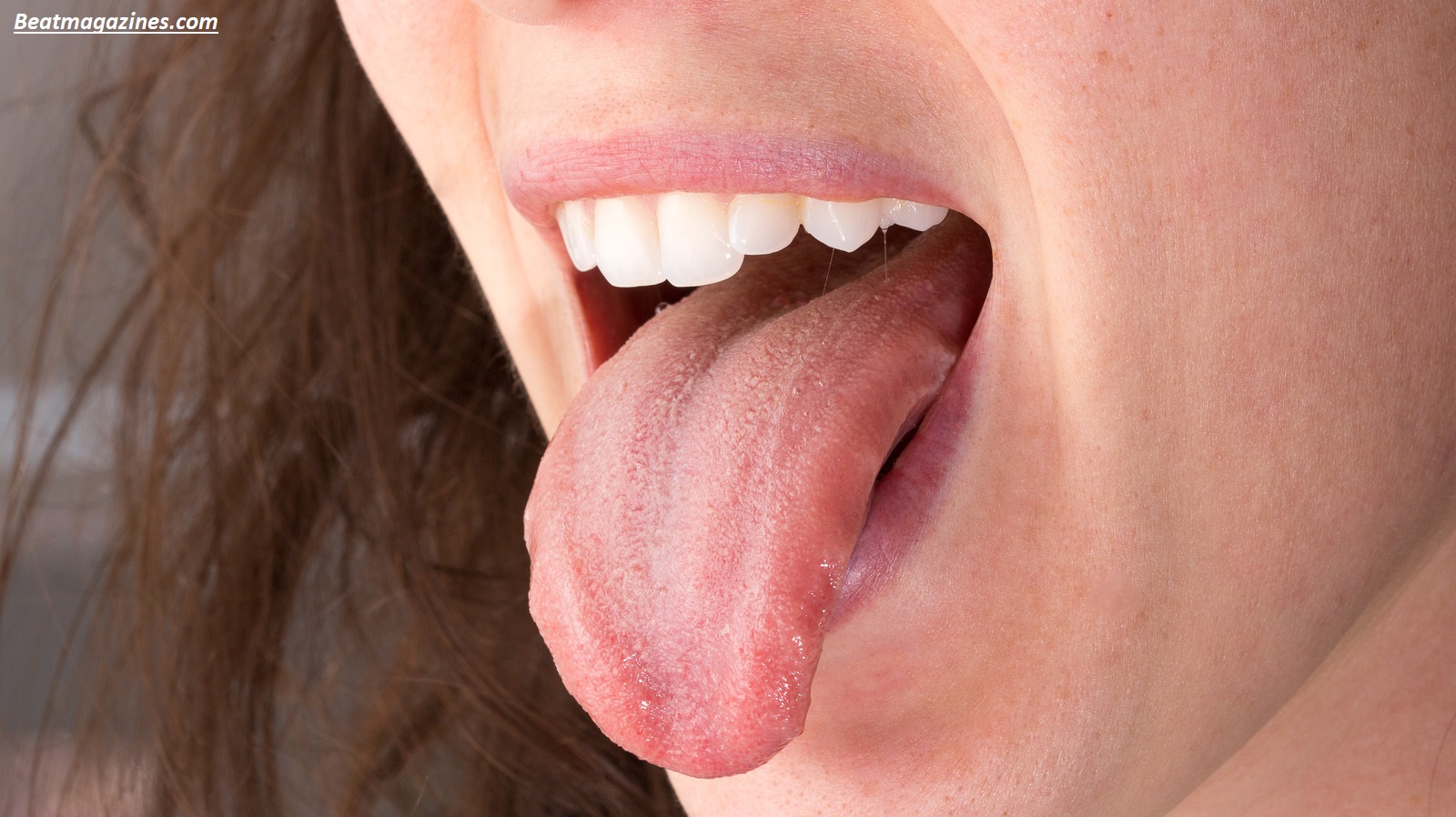 Why Does My Tongue Hurt on the Side? 9 Common Causes
